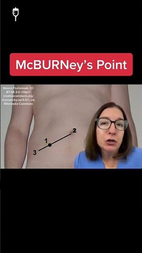 McBurney's point: Medical-Surgical SHORT |