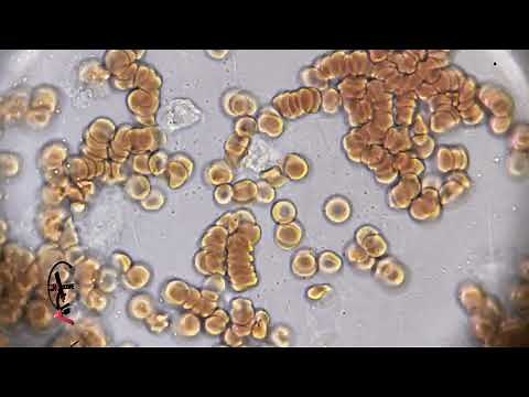 White blood cells under the microscope 2000X