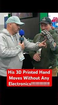 His 3D Printed Hand Restored Quality of Life #3dprinting #3dprinter @Creality3D