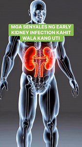 44K views · 461 reactions | Mga Senyales ng Early Kidney Infection Kahit Wala Kang UTI Symptoms #GoOrganique #healthtips #health | Go Organique Main | Facebook
