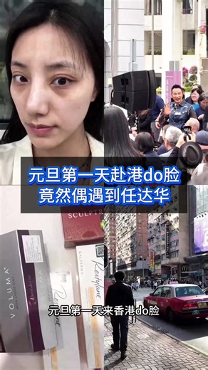 元旦第一天赴港整容竟然偶遇任達華 On the first day of the New Year, I went to Hong Kong for a facial and unexpectedly bumped into Simon Yam #香港 #hongkong #SimonYam #整容 #sculptra