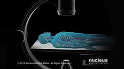 coronary angiography | Cardiology and CCU