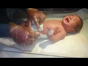 How to Pass Glycerin Suppository in Baby | Relieve Abdominal Distension Step by Step