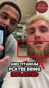 Why didn't Jake Paul shave his beard during his jaw surgery?#usa #foryou #celebrity #jakepauler