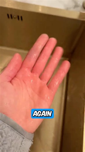 Her Finger Tips Looked Like This 😭