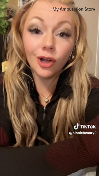 How I lost my legs and why I fought for my life. Its taken 5 years to get to a place where I feel brave enough to share my story. Happy to be here #amputee #bilateralamputee #survivorstory #survivor #doubleamputee #motherlove #god #amputeelife