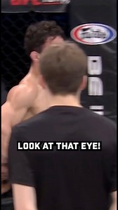 1.4M views · 6.6K reactions | Do NOT Blow Your Nose After an Eye Injury ❌ | Cage Warriors | Facebook