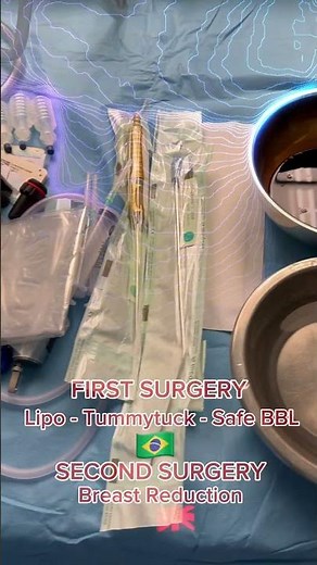 Watch Today’s Life-Changing Surgeries! #safebbl #plasticsurgeon #bodyshaping #beauty #liposuction