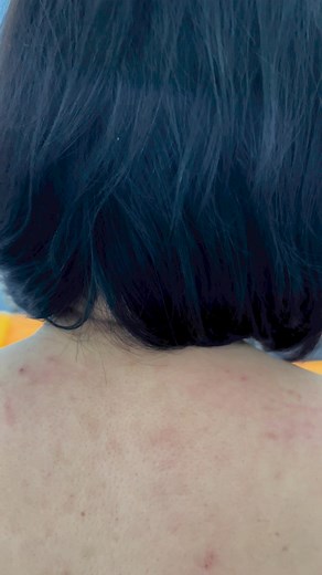 8.7K views · 63 reactions | Trong trị liệu bằng Y học cổ truyền nếu muốn nâng cao hiệu quả điều trị thì ngoài Thầy Thuốc cần có chuyên môn cao ra thì cũng rất cần sự phối hợp từ thay đổi thói quen xấu, tập luyện, ăn uống, ngủ nghỉ khoa học để lấy lại "Sự cân bằng" cho cuộc sống. #bacsimuoi #chamcuu #tieudaocham | Nguyễn Đỗ Mười | Facebook