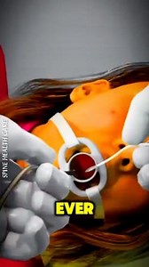 How A Gastric Balloon Works 3D Animation gastric balloon work #gastricballoon #gastricballoonjourney | Spine Health Care