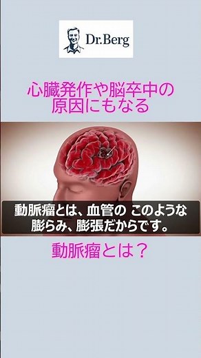 動脈瘤とは？ #shorts #動脈瘤 #心臓発作 #脳卒中 #ドクター・バーグ