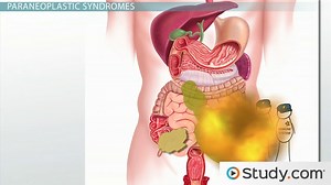 Pathophysiology of Cancer | Causes & Body Changes - Video | Study.com