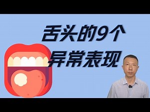 9 Abnormal Tongue Manifestations