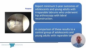 AANA 2025: Labral Reconstruction Shows Favorable Outcomes in Adolescents and Young Adults