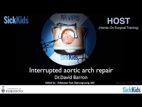 Interrupted aortic arch (type B) repair - Dr.David Barron