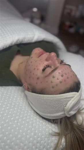 Meet Redness Relief RX 🌿 A Korean PDT (Photodynamic Therapy) treatment activated by light therapy to calm inflammation and support skin healing from within. 🌿 Helps with: • Breakouts & acne-prone skin • Redness & sensitivity • Dehydration • Uneven texture The light activates powerful ingredients that work deeper in the skin to soothe, hydrate, and restore balance making it perfect for stressed or reactive skin. Glowy, calm, healthy skin starts here. 💆‍♀️✨ For more info on this treatment DM “R