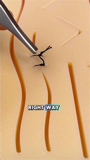 Suture Removal: Right VS Wrong (Watch This!) #sutureremoval #pastudent #npstudent #medstudent