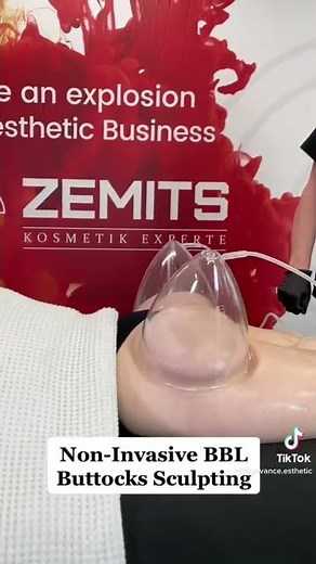 Non-Invasive BBL Buttocks Sculpting with Vacuum Cupping body remodeling system and XXL vacuum cups🔥
