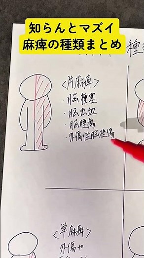 麻痺の種類覚えてますか？ #看護師 #勉強 #ママナース