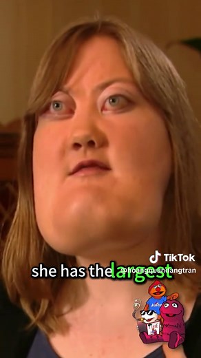Top 5 People with the Largest Body Parts