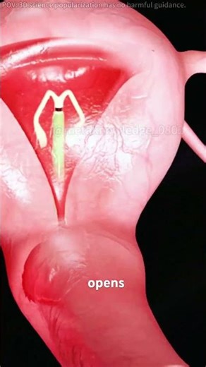 Intrauterine Device (IUDs) For Birth Control#iud #intrauterinedevice #birthcontrol #iudinsertion