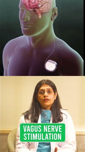 Epilepsy is Treatable: Advanced Solutions & Seizure Control | Dr Sreelakshmi N