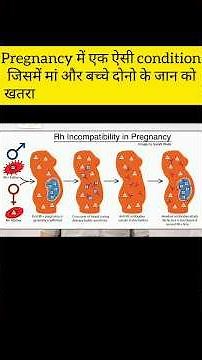 Rh Factor Incompatibility !!#shorts #ytshorts #mediqbysuhel