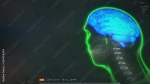 Medical software monitoring patient's brain activity, MRI test results on screen. Computer screen with patient's screening results Stock Video