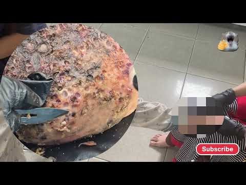 🛑 Extreme Jigger Build-Up – Thick Plates of Skin Detached! #DF237