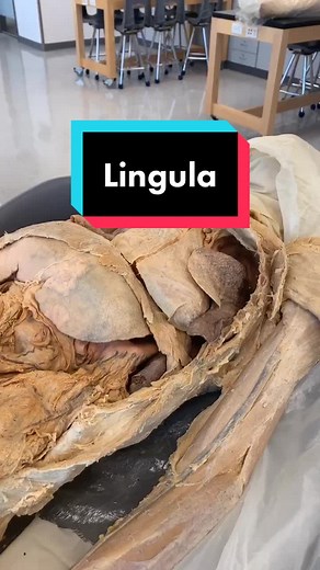 Exploring the Mysterious Lingula in Left Lungs
