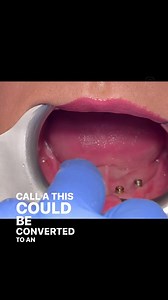 Always a solution Here s a real, simple video showing how a denture...