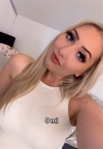 Lip Filler Treatments Explained for First-Timers