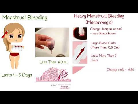 Heavy Menstrual Bleeding - What causes heavy periods? how much menstruation is normal?