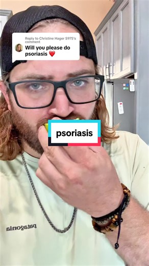 Holistic Guide to Wellness for Psoriasis Management