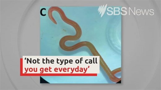 Live eight-centimetre worm parasite removed from woman's brain