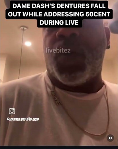 Dame Dash dentures fell out on live