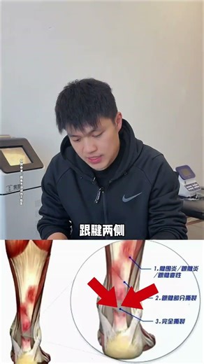 保姆级小腿跟腱放松教程！体育生/跑步党必看，新手照着做，跟腱炎、小腿僵硬全拜拜！#筋膜放松 #跟腱炎 #小腿酸胀 #体育生 #马拉松