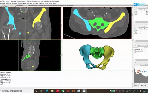 3.mimics基础教程