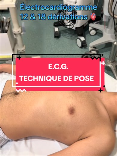 Comment faire un ECG. Technique de pose... #fyp #culture #medecine #ecg