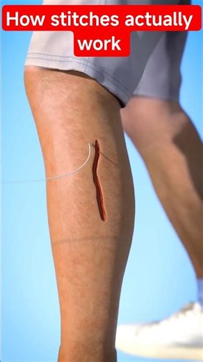 How Stitches Actually Work