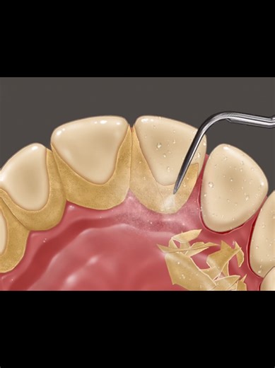 Teeth Treatment asmr #foryoupage❤️❤️ #treatment #asmr | ASMR