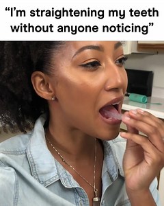 407K views · 258 reactions | Straighten AND whiten your teeth at 1/3 the cost of braces. Only one office visit. Get your free smile assessment today.  | Candid | Facebook