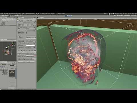 Volume Rendering in Unity 2/2