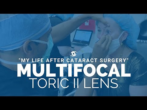 Review of the *NEW* Multifocal Toric II lens (1st Patient in Georgia)