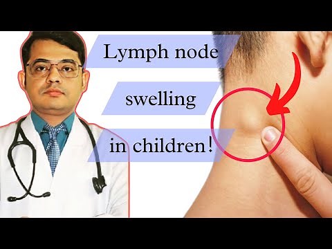 Lymph node swelling in children|Lymphadenopathy:Cause, symptoms, treatment!