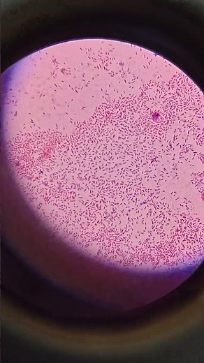 bacteria 🦠 in microscope (GNB)