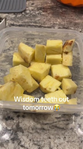 Praying pineapple actually makes your face less swollen after🙏🏻 #wisdomteethremoval #pineapple #pineapplejuice #surgery #fyp