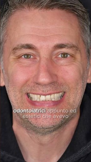 I SOLVED all my PROBLEMS with THEM! ADEC #milan dentist
