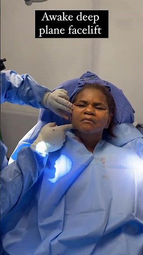 Results of an AWAKE DEEP PLANE FACELIFT