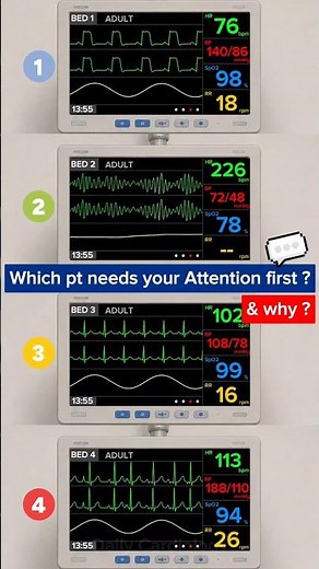 Which Patient Needs Your Attention FIRST? Can You Prioritize Correctly? #ecg #cardiology #emergency